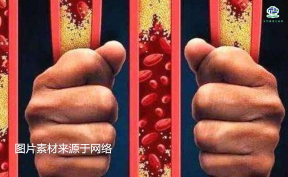 不想給血管“添堵”，盡量少吃以下這些東西，或許能讓腦梗離遠些  